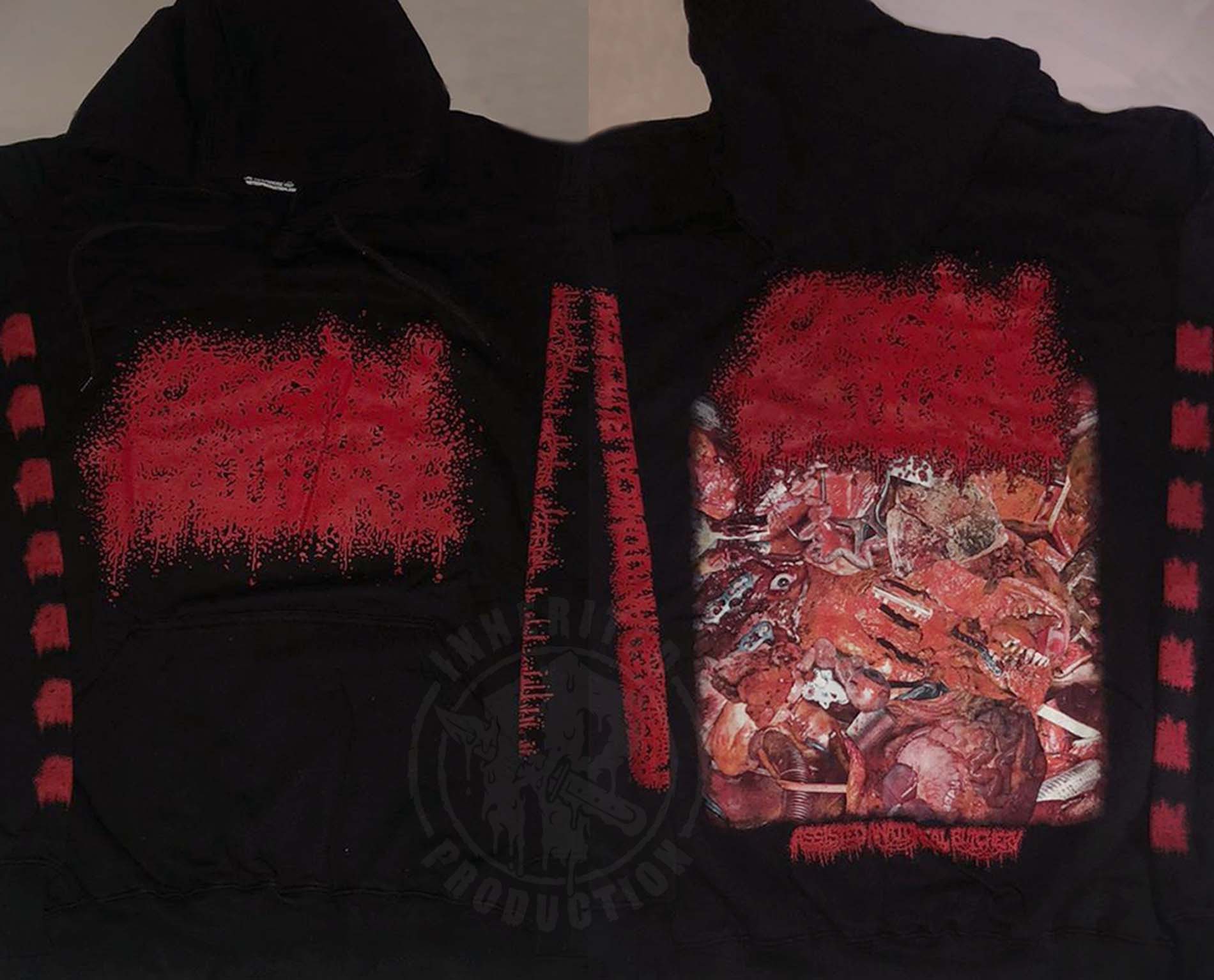 HOODIE – Organ Failure – Assisted Anatomical Butchery