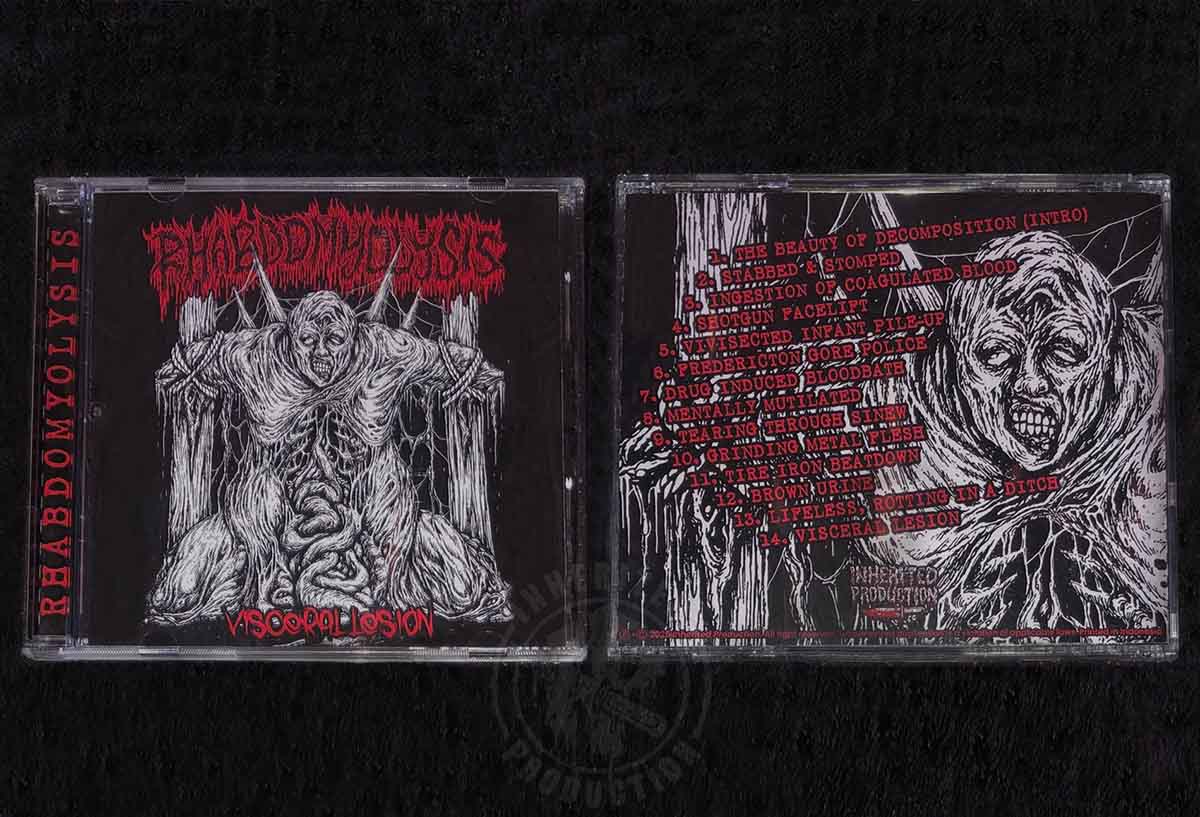 CD – Rhabdomyolysis – Visceral Lesion