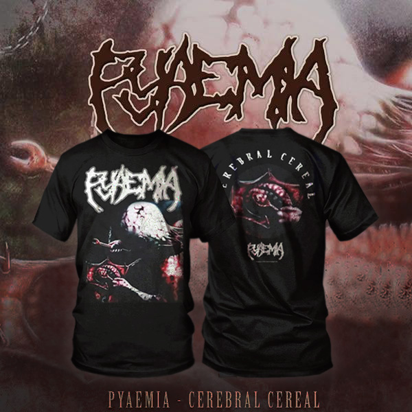 TS - PYAEMIA - CEREBRAL CEREAL