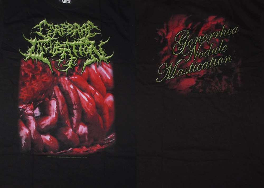 TS – CEREBRAL INCUBATION – Gonorrhea Nodule Mastication