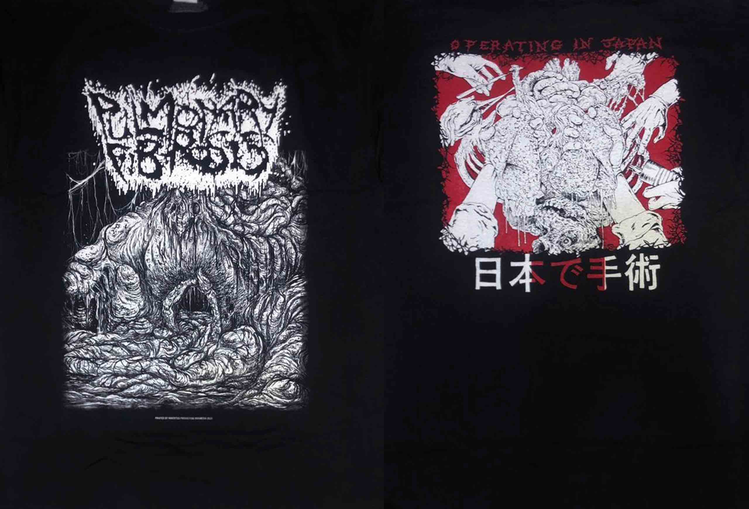 TS – Pulmonary Fibrosis – Operating in Japan