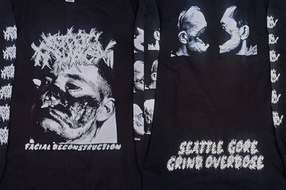 LS - Ectopic Pregnancy - Facial Reconstruction